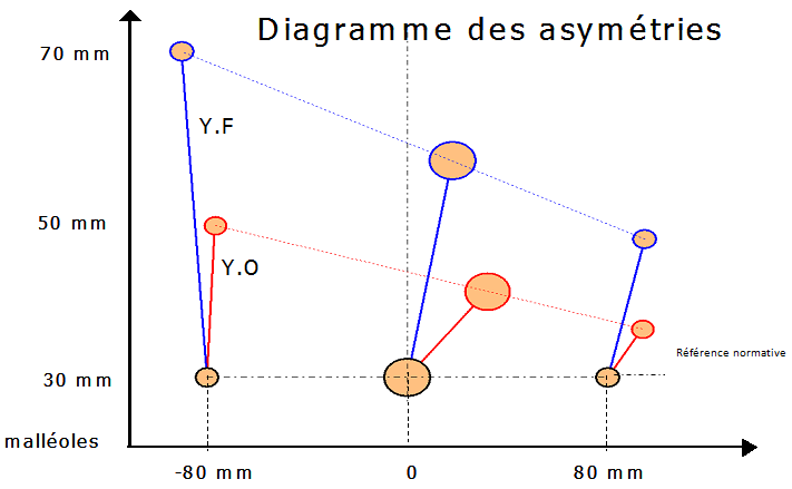 Pedana Stabilometrica Cyber Sabots - Diagramma delle asimmetrie